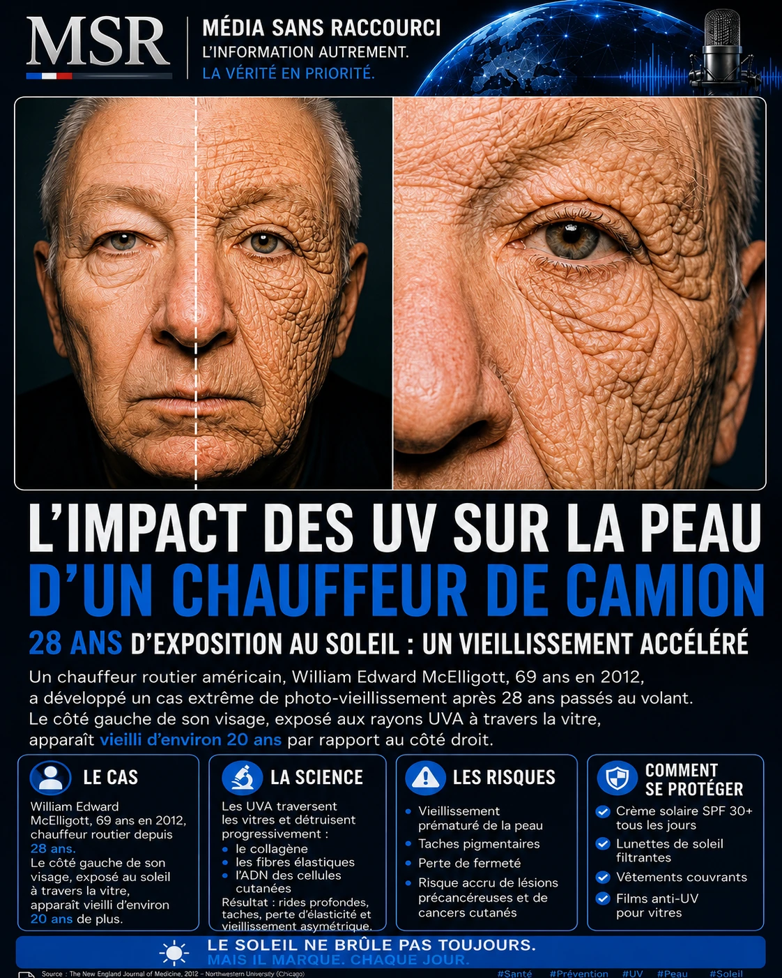 Ce visage raconte 28 ans d’exposition au soleil